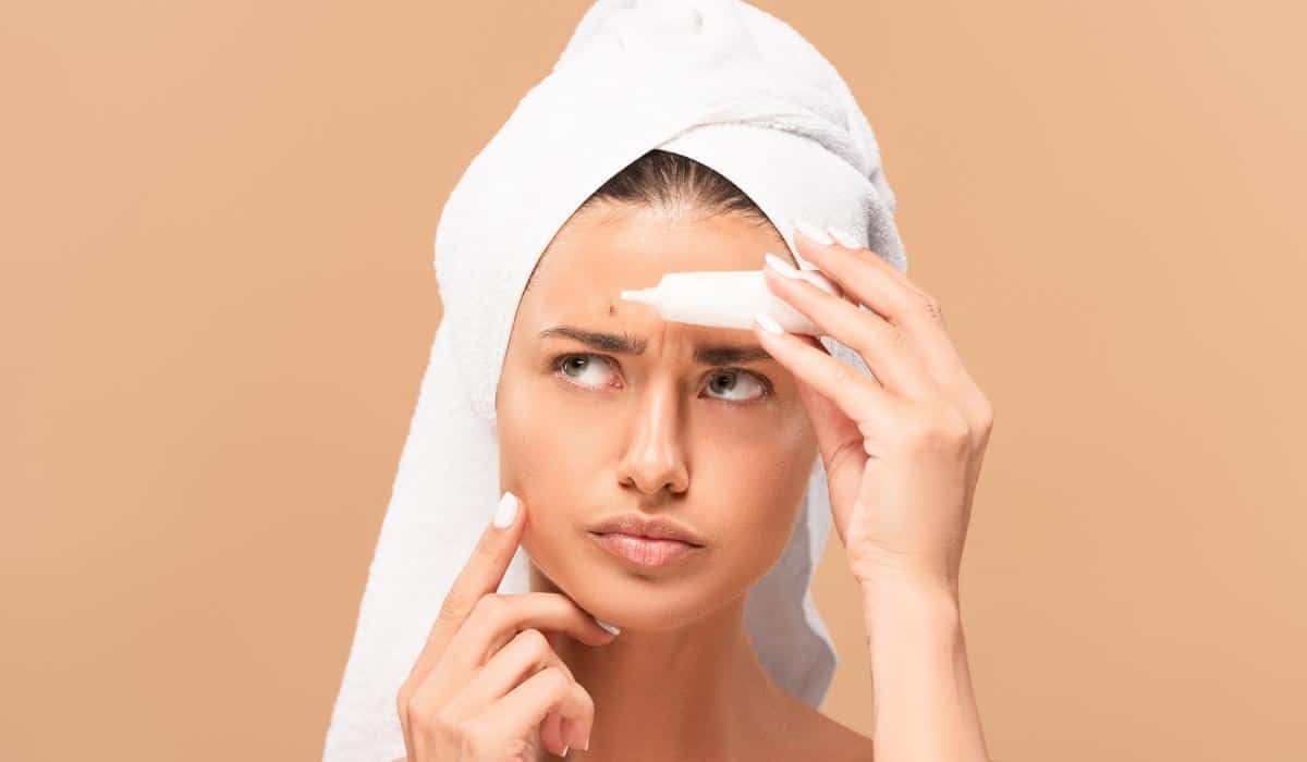 TIPS CAN HELP YOU TO PREVENT ACNE AND PIMPLE PROBLEMS